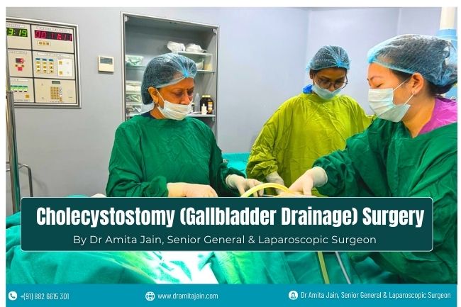 Cholecystostomy Gallbladder Drainage Surgeon Dr Amita Jain Cholecystostomy Gallbladder Drainage Surgeon Dr Amita Jain